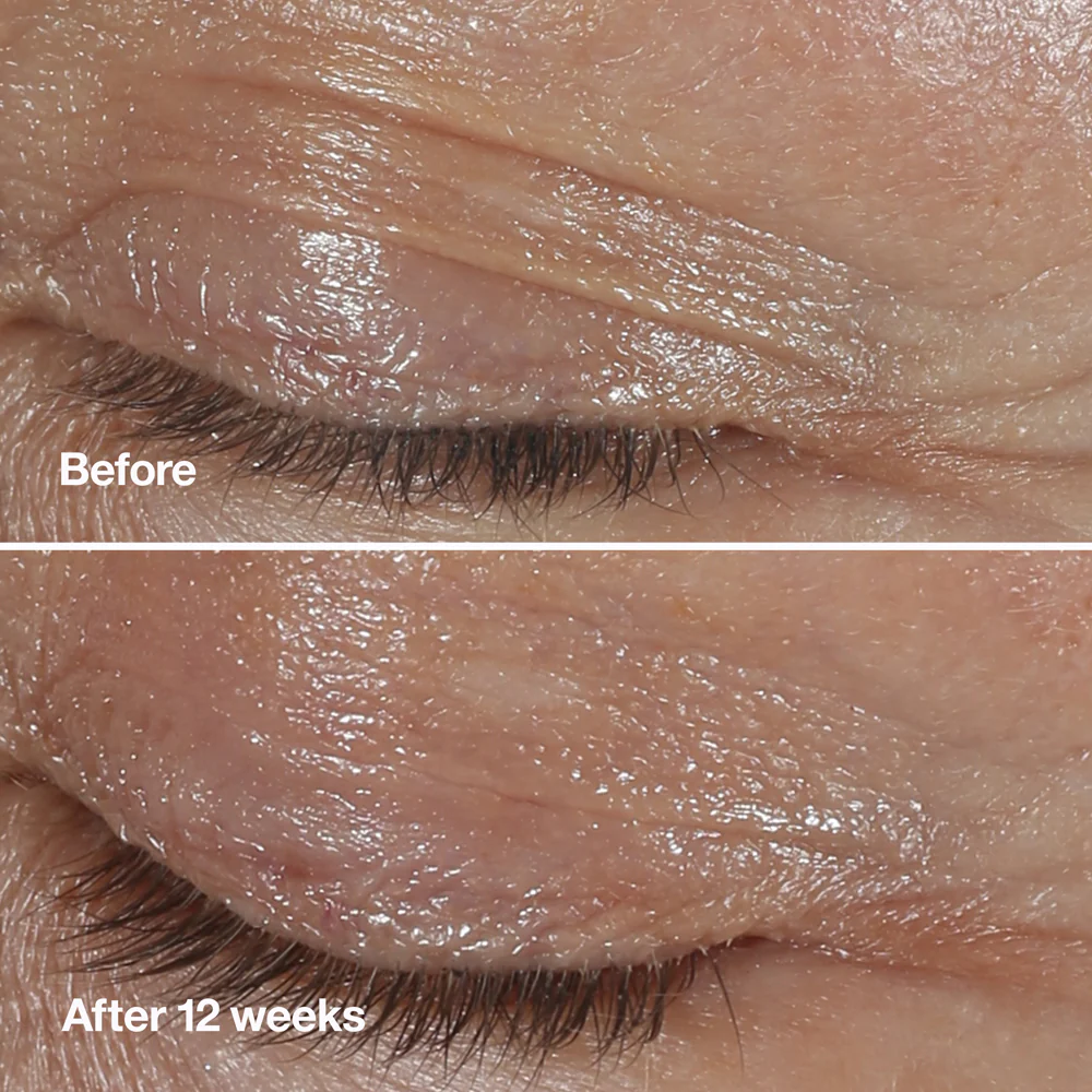 Smart Clinical Repair™ Wrinkle Correcting Eye Cream korygujący krem przeciwzmarszczkowy pod oczy 30ml - Image 3