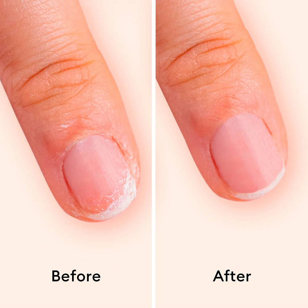 Keratine Booster wzmacniająca odżywka do paznokci 15ml - Image 3