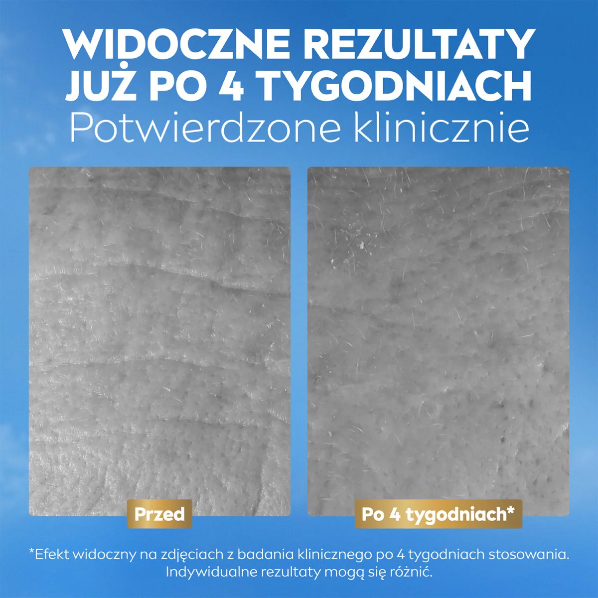 Q10 Przeciwzmarszczkowy Ekspert Kolagenu masełko do twarzy na dzień i noc 50ml - Image 3
