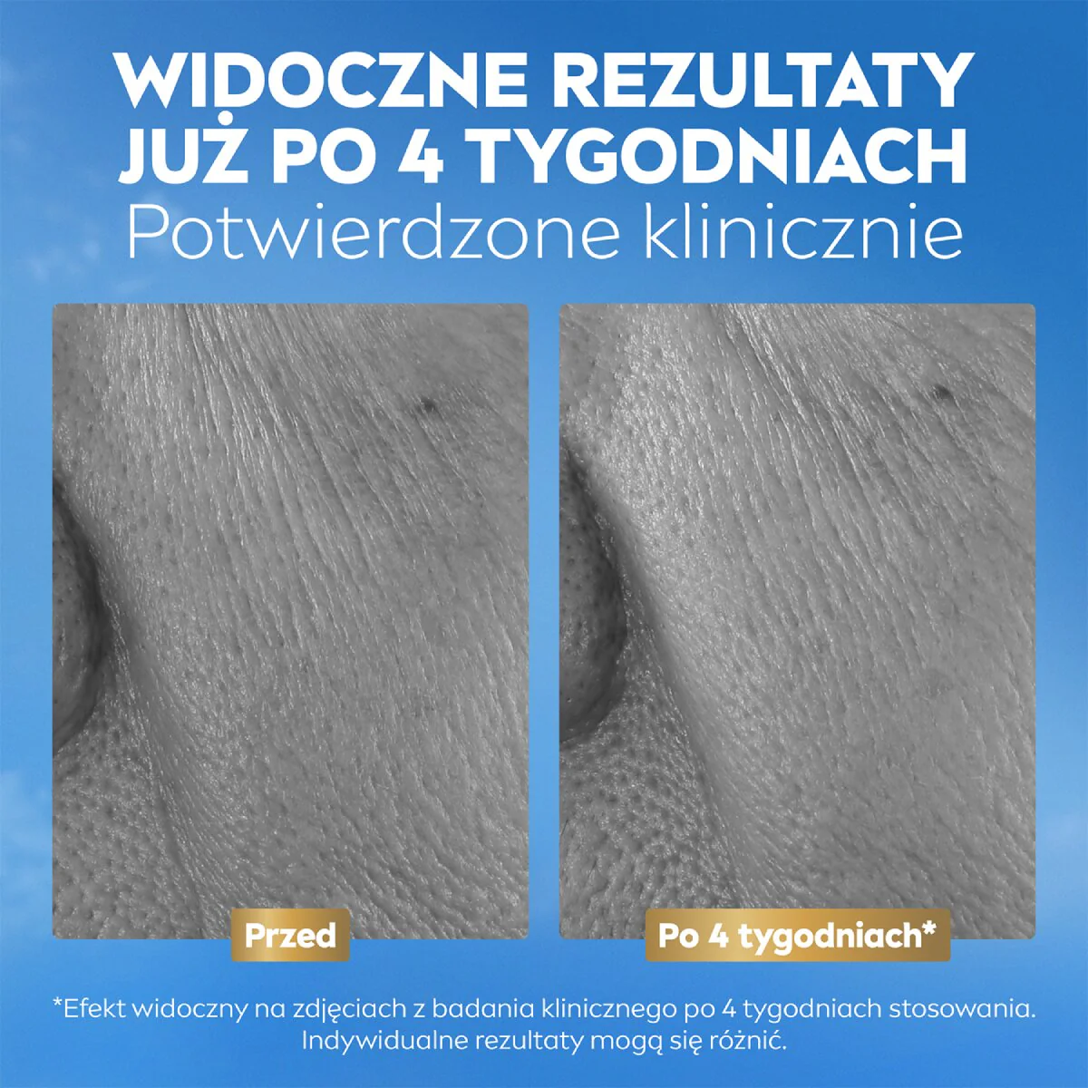 Q10 Przeciwzmarszczkowy Ekspert Kolagenu serum naprawcze 3w1 30ml - Image 3