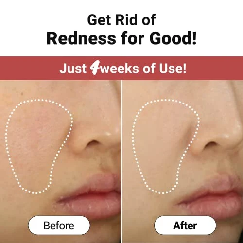 Clear Redmark Soothing Facial Sheet Mask łagodząca maska w płachcie 25ml - Image 3